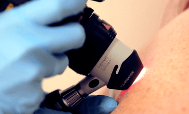 Diagnosis of plantar warts